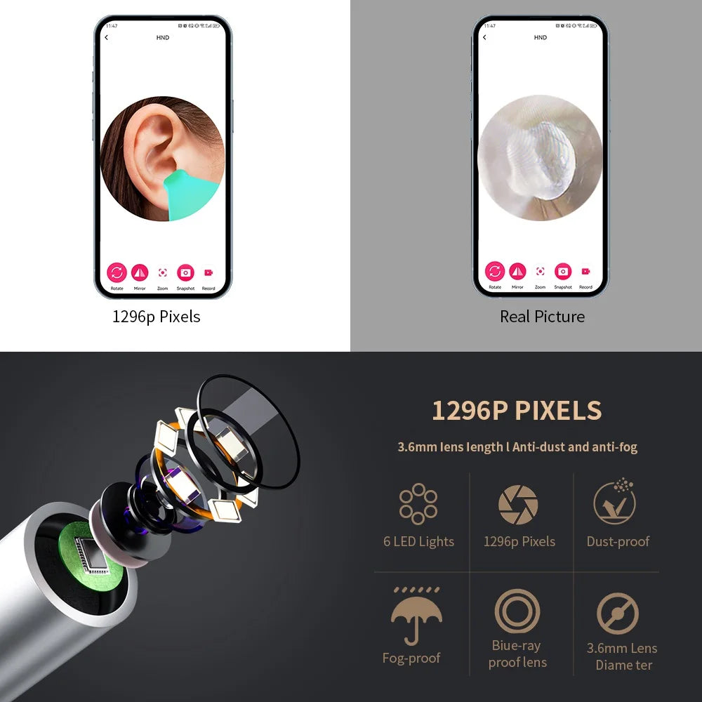 ClearView™ – Wireless Smart Ear Cleaner with HD Camera