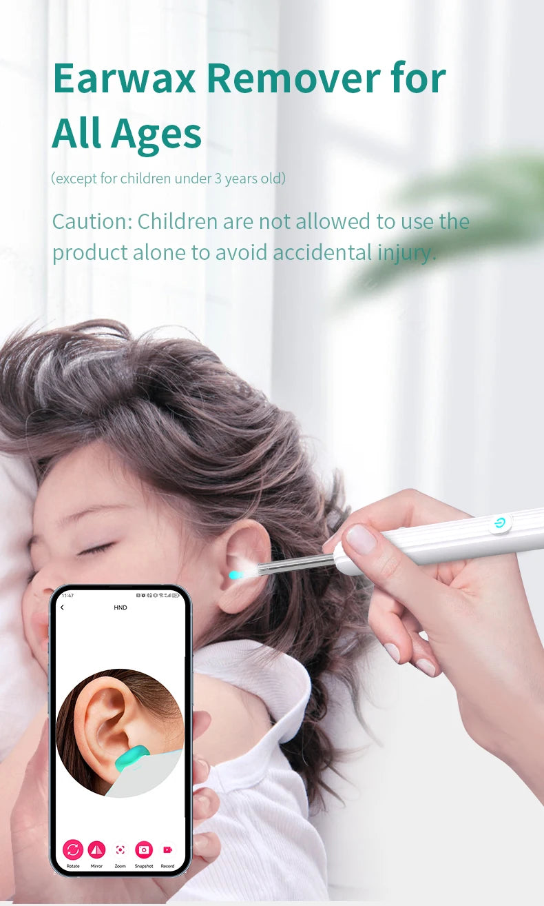 ClearView™ – Wireless Smart Ear Cleaner with HD Camera