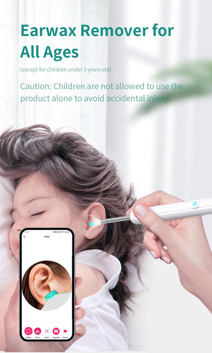 ClearView™ – Wireless Smart Ear Cleaner with HD Camera