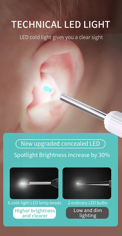 ClearView™ – Wireless Smart Ear Cleaner with HD Camera