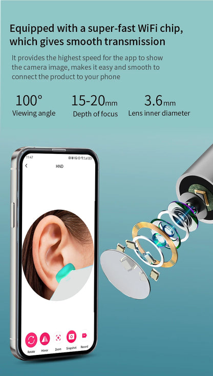 ClearView™ – Wireless Smart Ear Cleaner with HD Camera